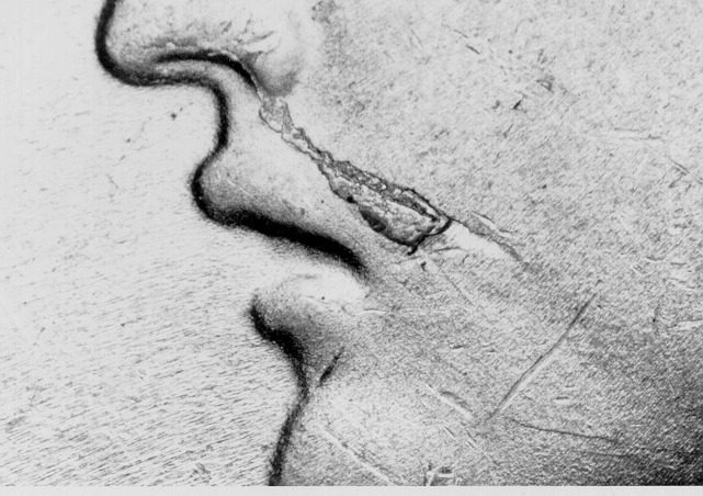 Close-up of a carved stone face.