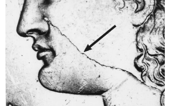 Profile illustration with arrow pointing at jaw.